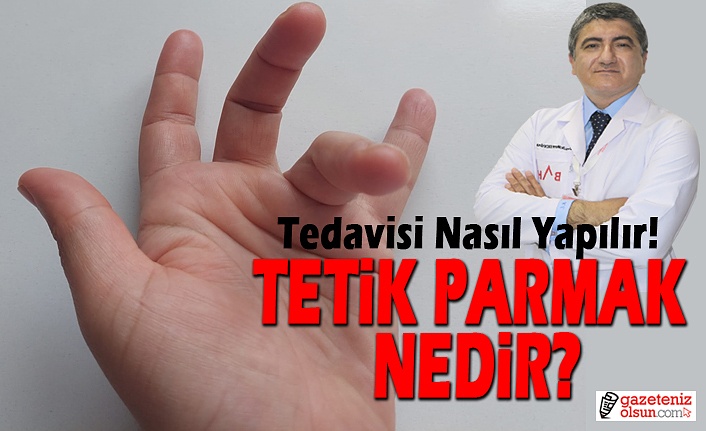 Tetik Parmak Nedir, Tedavisi Nasıl Yapılır!