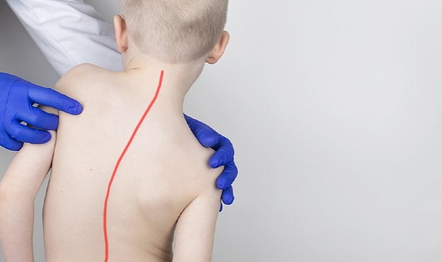 Skolyoz Tedavisinde Doğru Sanılan 7 Yanlışa Dikkat!