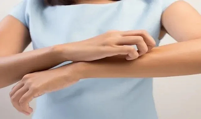 Kaşınma: Sinir ve Bağışıklık Sistemi Etkisi Ortaya Çıktı