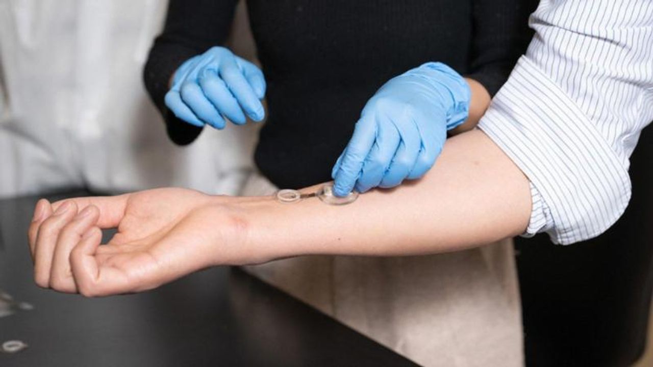 Caltech iCares Akıllı Bandajı Yara Enfeksiyonunu Erken Tespit Ediyor