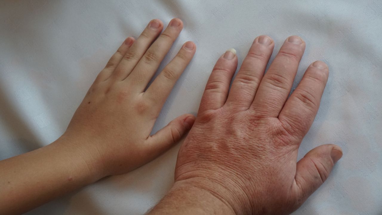 Axolotl’da Uzuv Yenileme Sırrı Retinoik Asit ile Çözüldü