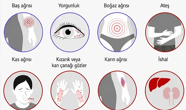 DSÖ, Kongo Demokratik Cumhuriyeti’ndeki Ebola Salgını İçin Acil Durum İlan Etti